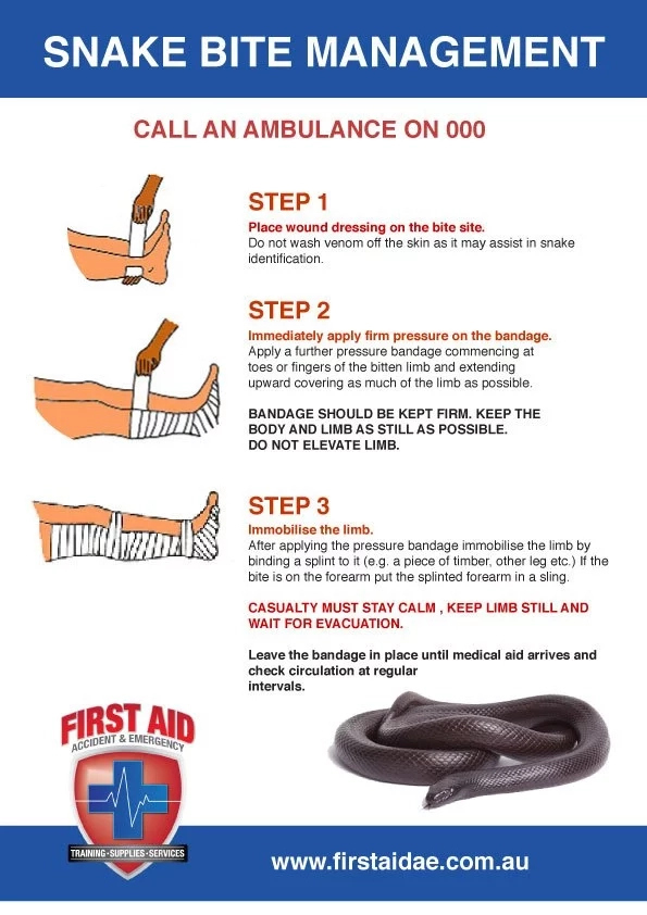 7 First Aid Tips for Snake Bite
