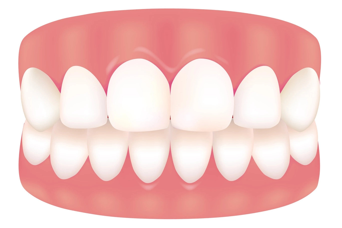 How to Care for the Teeth and Gums