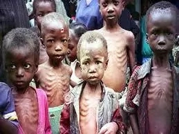 Malnutrition in Nigeria: Symptoms, Causes and the way out