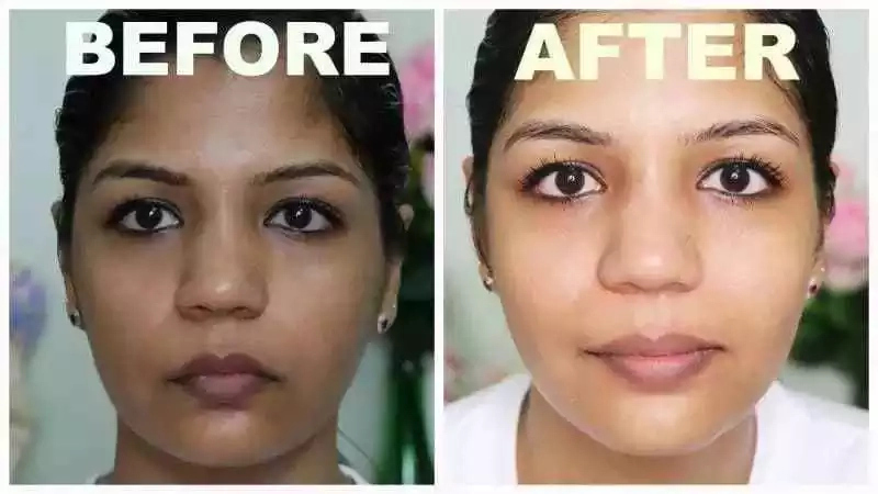 Best Quality Bleaching Creams in Nigeria